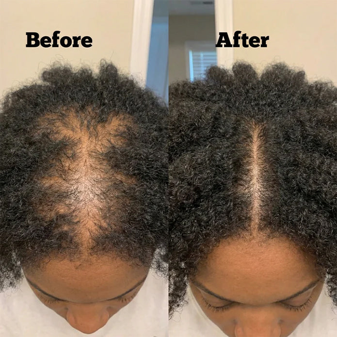 Before and after result image
